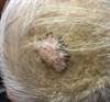 DermDx: A growth on the scalp in an elderly man DermDx: A growth on the scalp in an elderly man