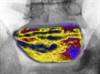Stat Consult: Chronic Low Back Pain Stat Consult: Chronic Low Back Pain