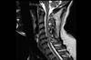 Ortho Dx: Radiating Neck and Upper Extremity Pain Ortho Dx: Radiating Neck and Upper Extremity Pain