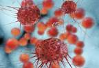 Investigational Therapy Gets Fast Track Status for Recurrent Ovarian Cancer Investigational Therapy Gets Fast Track Status for Recurrent Ovarian Cancer