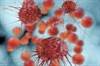 Investigational Therapy Gets Fast Track Status for Recurrent Ovarian Cancer Investigational Therapy Gets Fast Track Status for Recurrent Ovarian Cancer