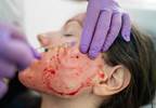 Patrons of 'Vampire Facial' Spa May Have Been Exposed to HIV Patrons of 'Vampire Facial' Spa May Have Been Exposed to HIV