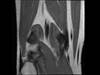 Ortho Dx: Leg Pain and Numbness Ortho Dx: Leg Pain and Numbness