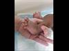 Image of the Week: Deformities Found During a Newborn Examination Image of the Week: Deformities Found During a Newborn Examination