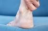 Image of the Week: Which Antibiotic Is Causing This Patient's Heel Pain? Image of the Week: Which Antibiotic Is Causing This Patient's Heel Pain?
