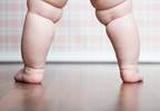 Cesarean Delivery Outcomes May Influence Risk for Early Childhood Overweight Cesarean Delivery Outcomes May Influence Risk for Early Childhood Overweight
