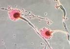 Voriconazole-Resistant Invasive Aspergillosis Associated With Higher Mortality Voriconazole-Resistant Invasive Aspergillosis Associated With Higher Mortality