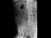 Ortho Dx: Assessing Chronic Lower Back Pain in an Older Man Ortho Dx: Assessing Chronic Lower Back Pain in an Older Man