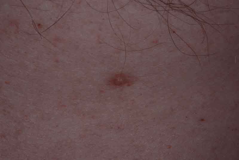 nipples Pics of
