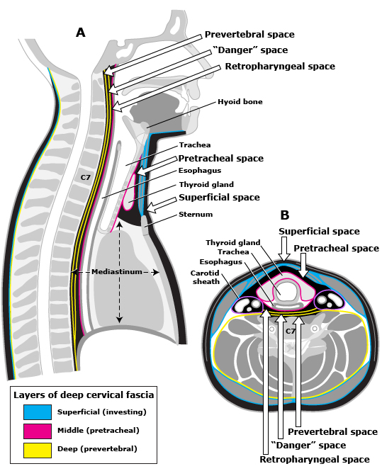 Infections of the oral cavity, neck, and head - The Clinical Advisor