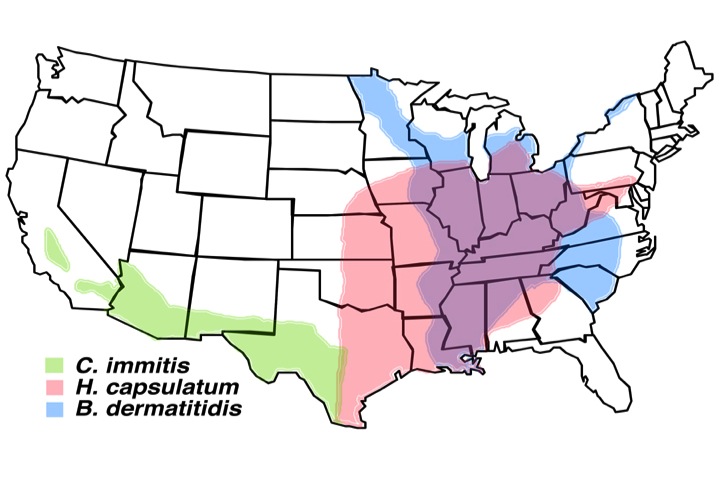 Blastomyces dermatitidis - The Clinical Advisor