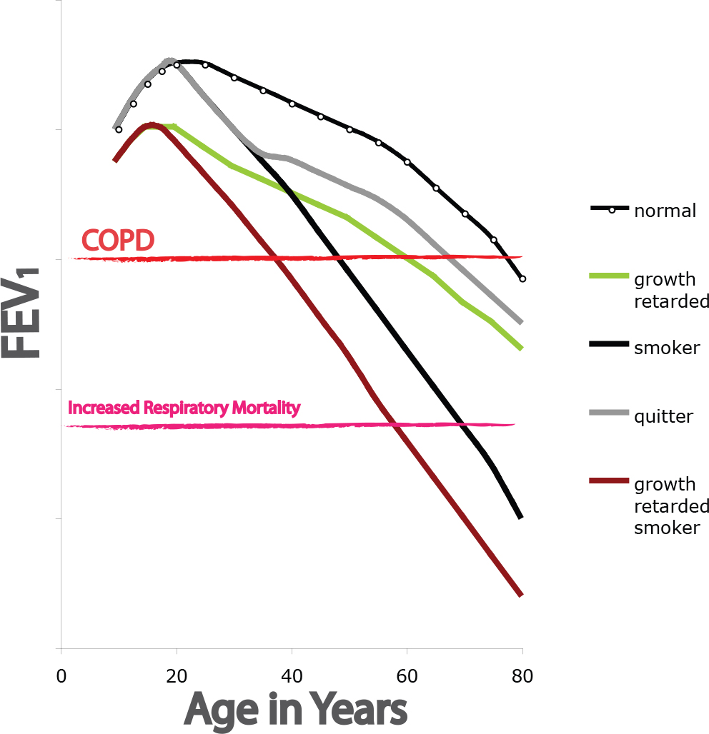 COPD Pathogenesis, Epidemiology, and the Role of Cigarette Smoke The