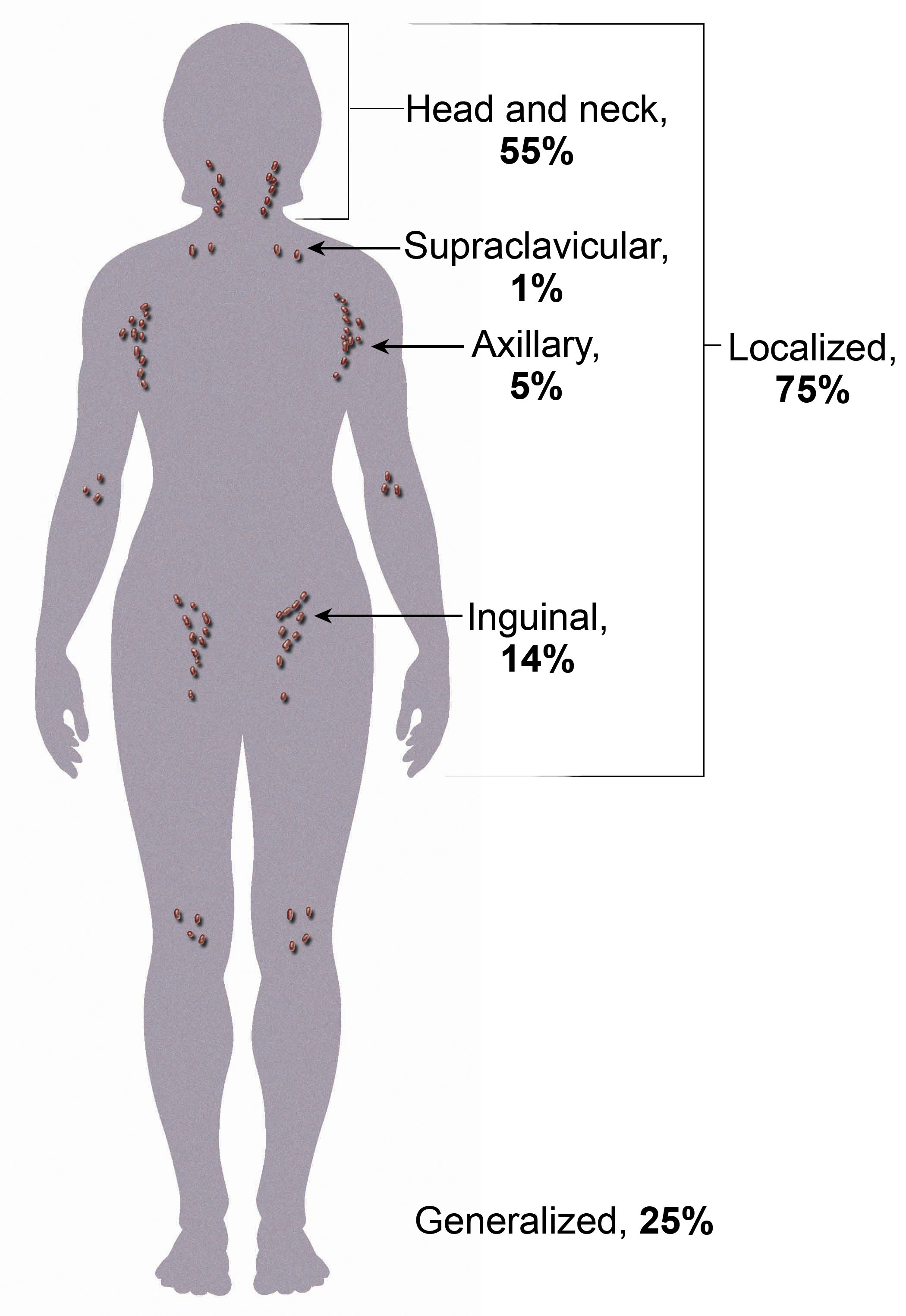 reasons for swollen supraclavicular lymph nodes