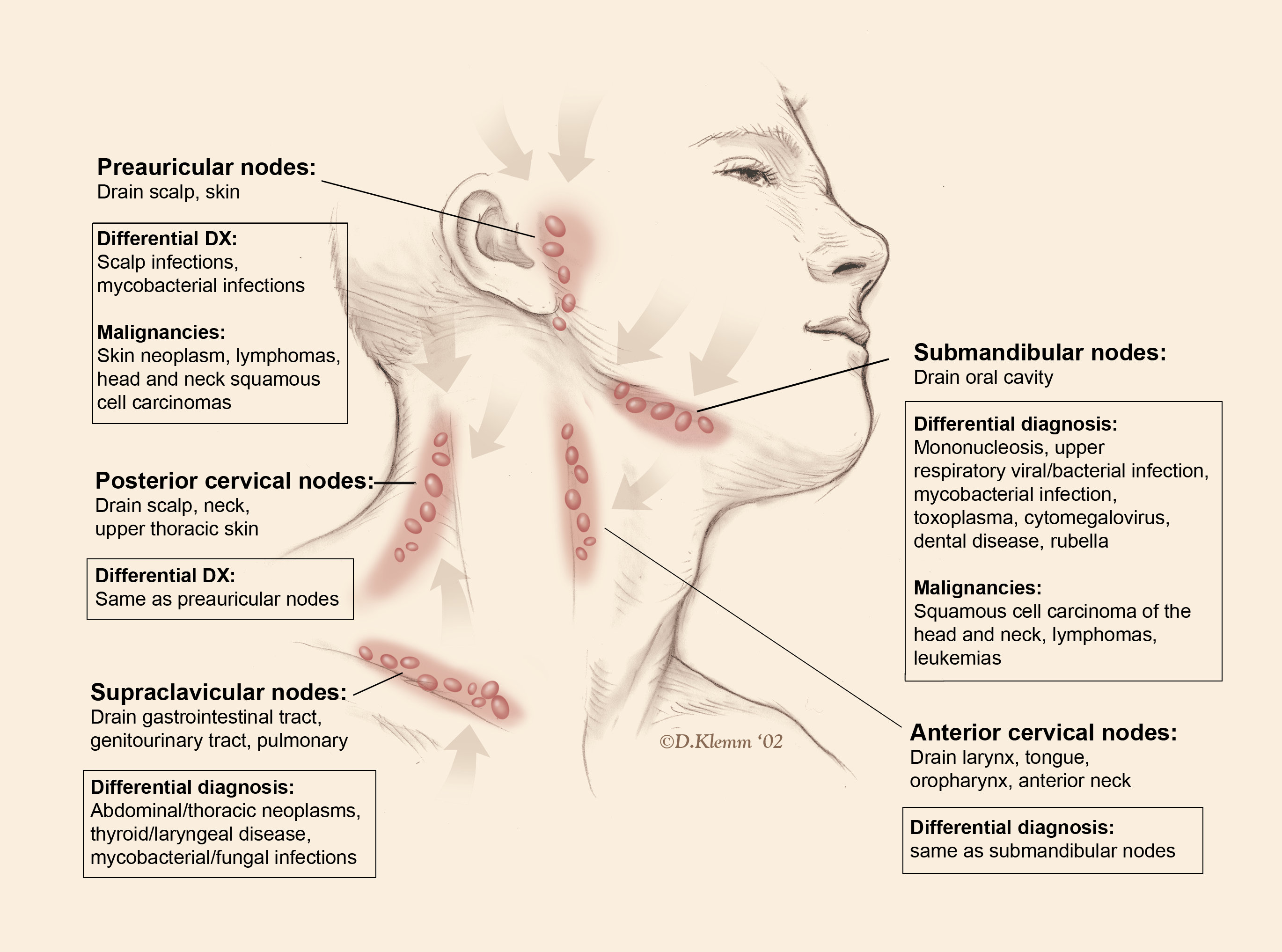 swollen lymph nodes in back of neckhead