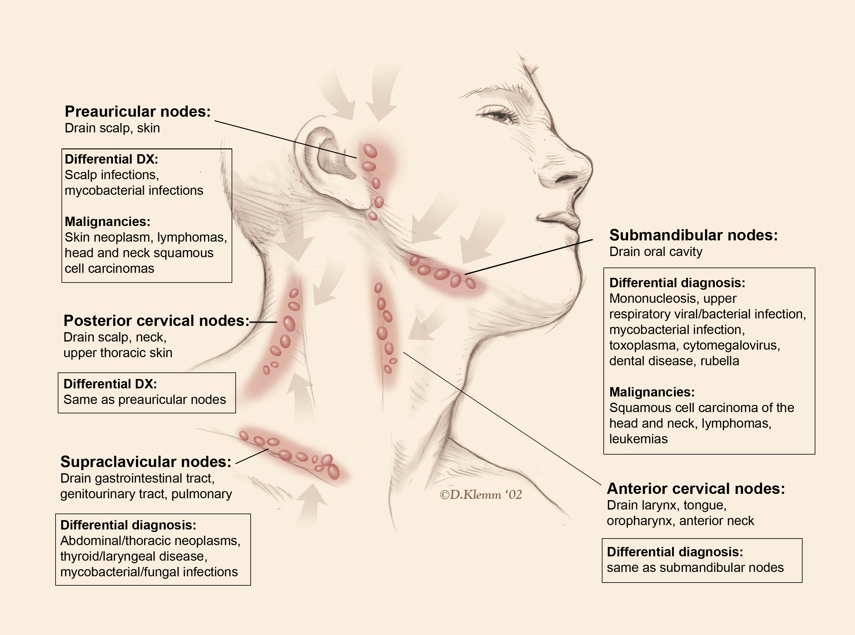 sore lymph node back of neck