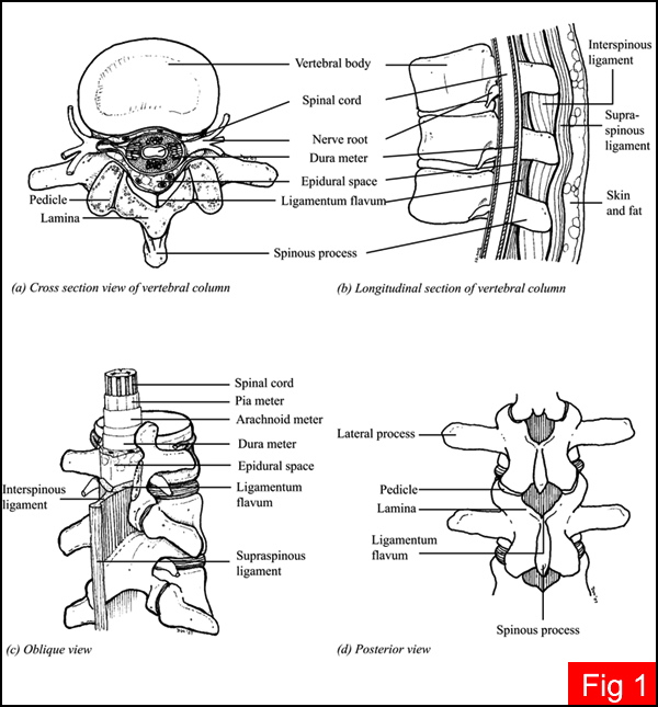 Epidural management, Epidural Analgesia, Epidural Anesthesia, Thoracic ...