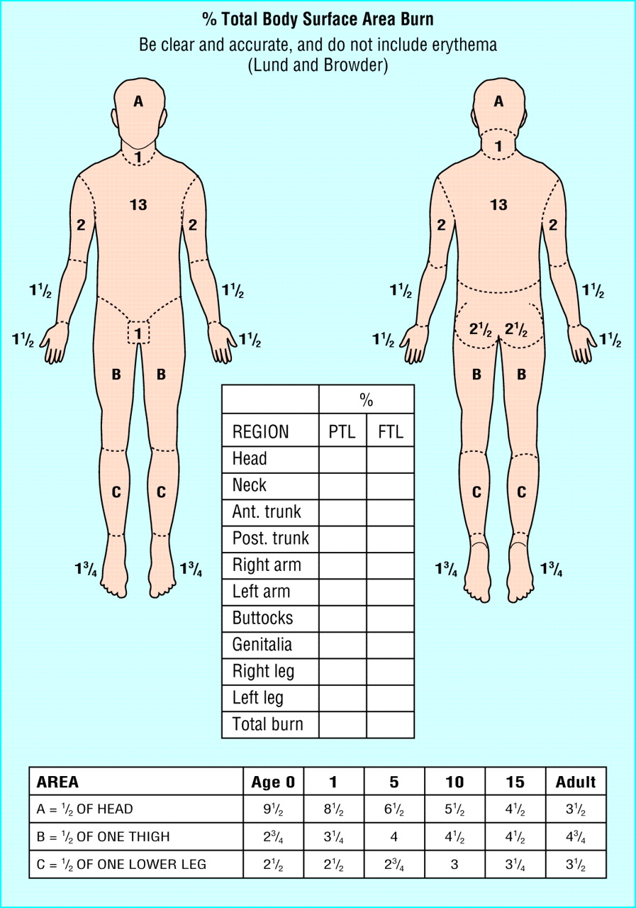 Burn shock, Resuscitation of Burn Shock, Burn Shock Resuscitation - The