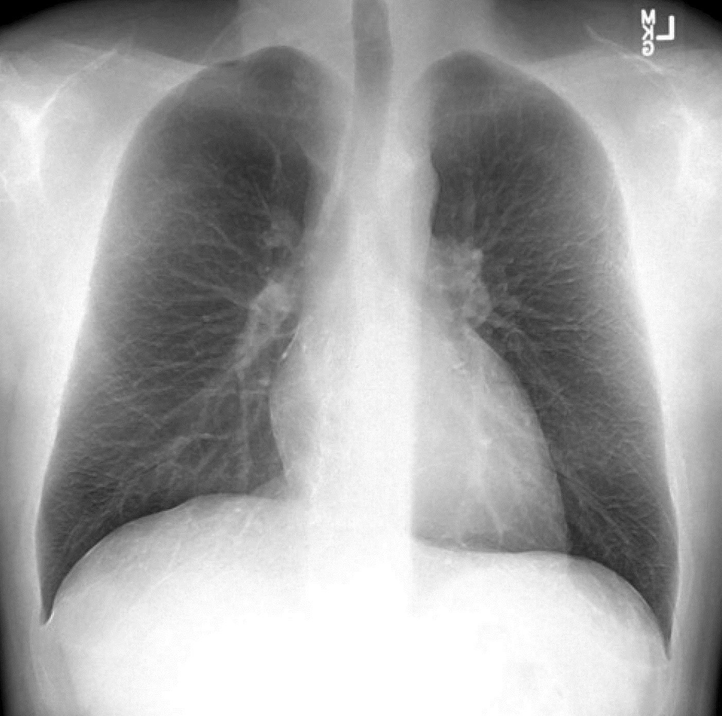 dual-energy-radiography-and-tomosynthesis-the-clinical-advisor