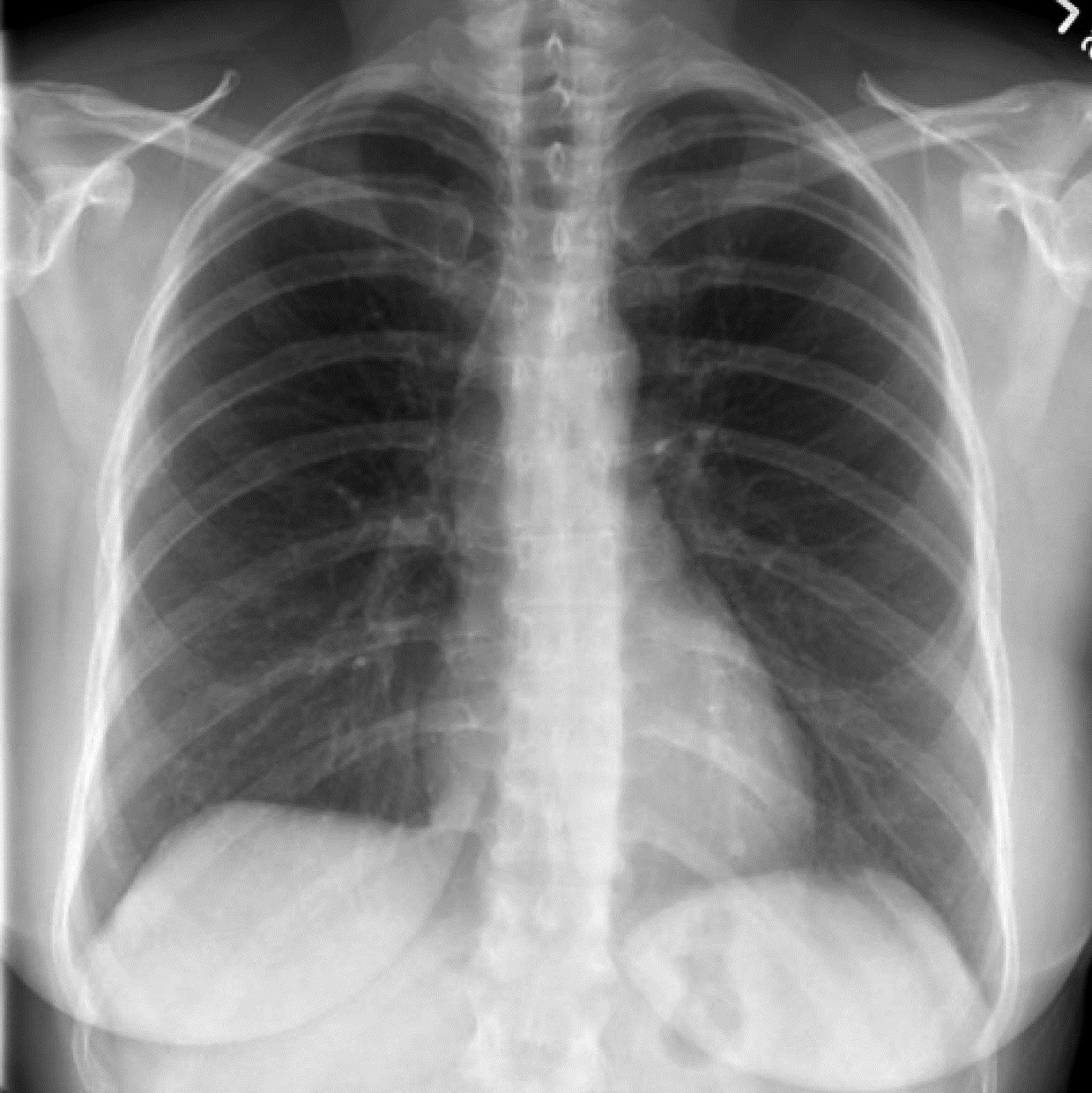 Dual energy radiography and tomosynthesis - The Clinical Advisor