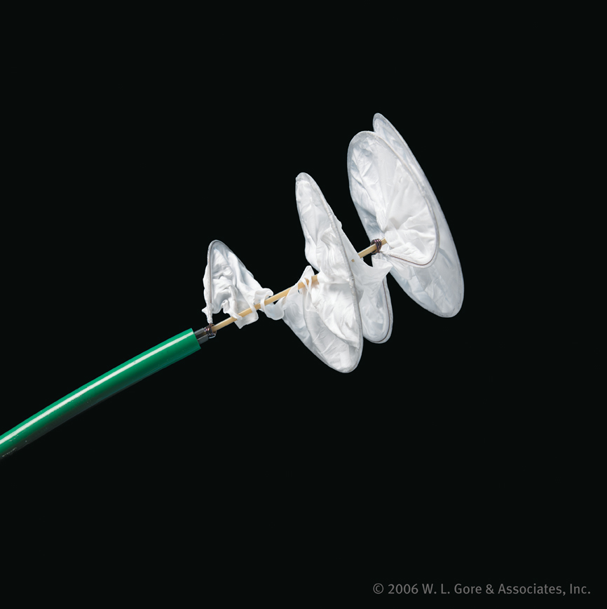 Patent Foramen Ovale/Atrial Septal Defect/Ventricular Septal Defect